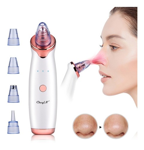 EXTRACTOR Y REMOVEDOR DE PUNTOS NEGROS